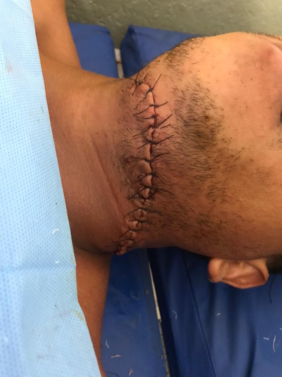 Depois de desentendimento homem tem pescoço cortado por esposa