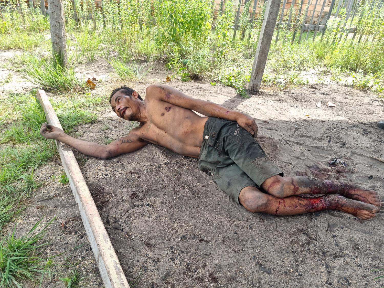 Homem tem braços e pernas quebradas no Bela Vista do Juá corretivo de facção