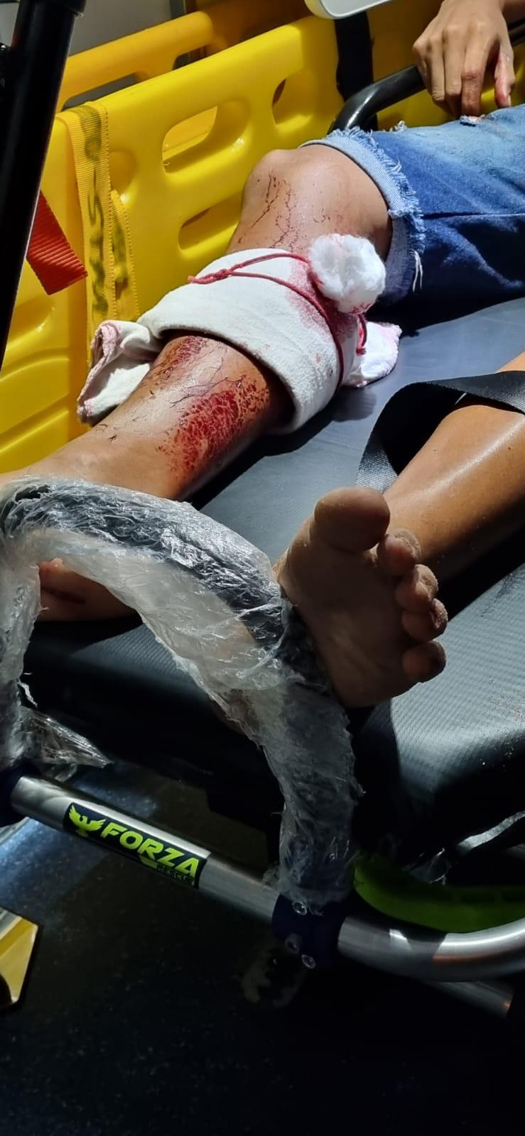 Na serra do indio na madrugada apreensão de entorpecentes e menor alvejado na perna