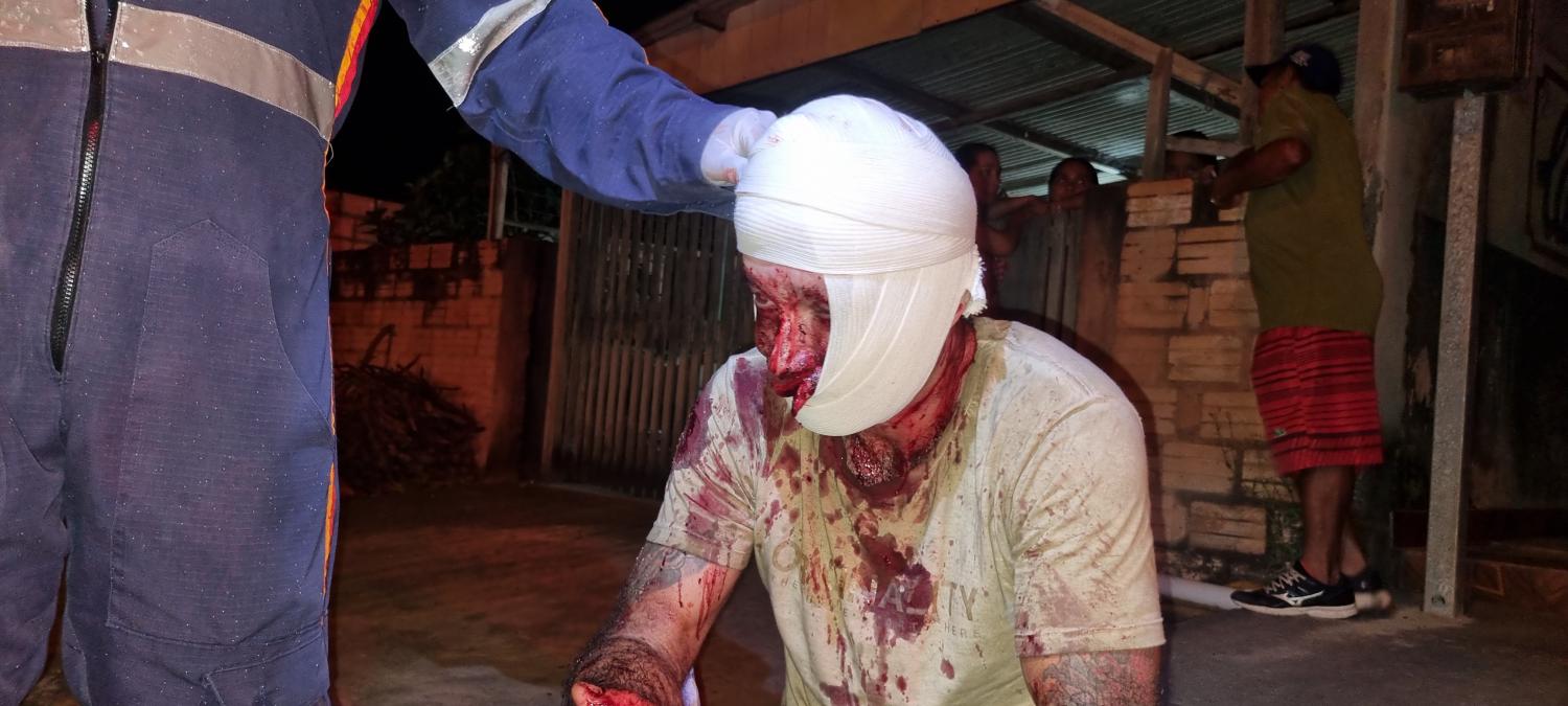 Homem brutalmente agredido no bairro do Mapiri