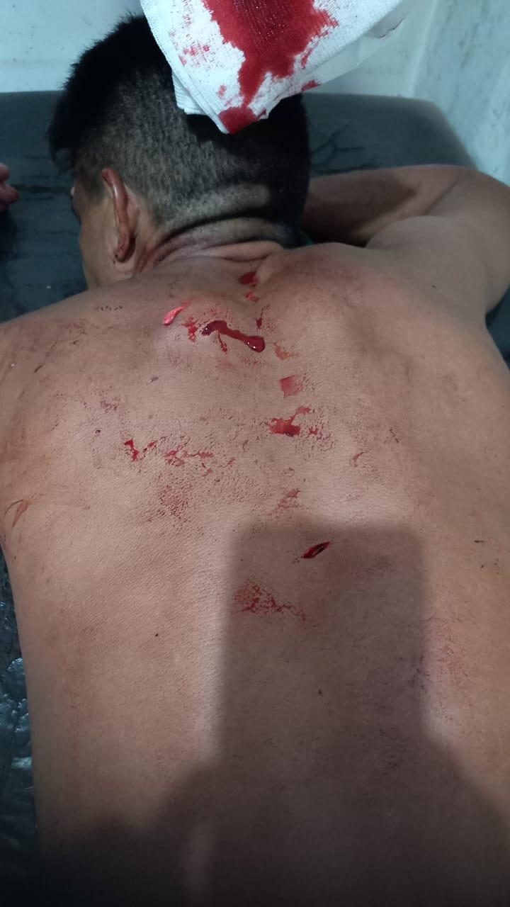 Homem esfaqueado na Vila de Curuai