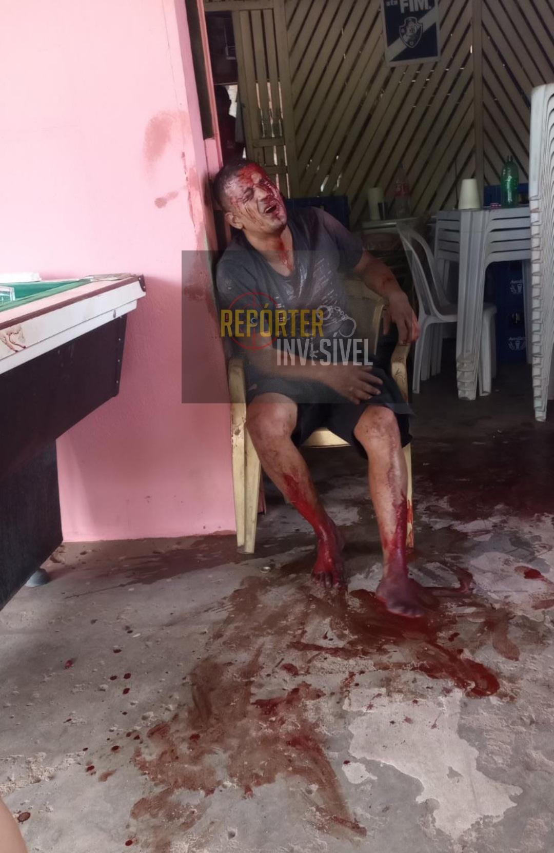 Elemento agredido por detrás muro do Shopping