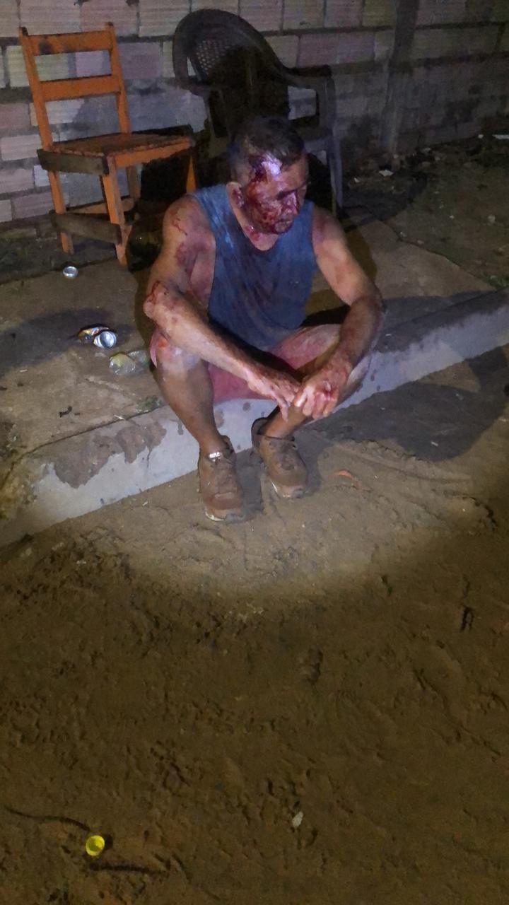 Homem tenta matar esposa no bairro de Uruará