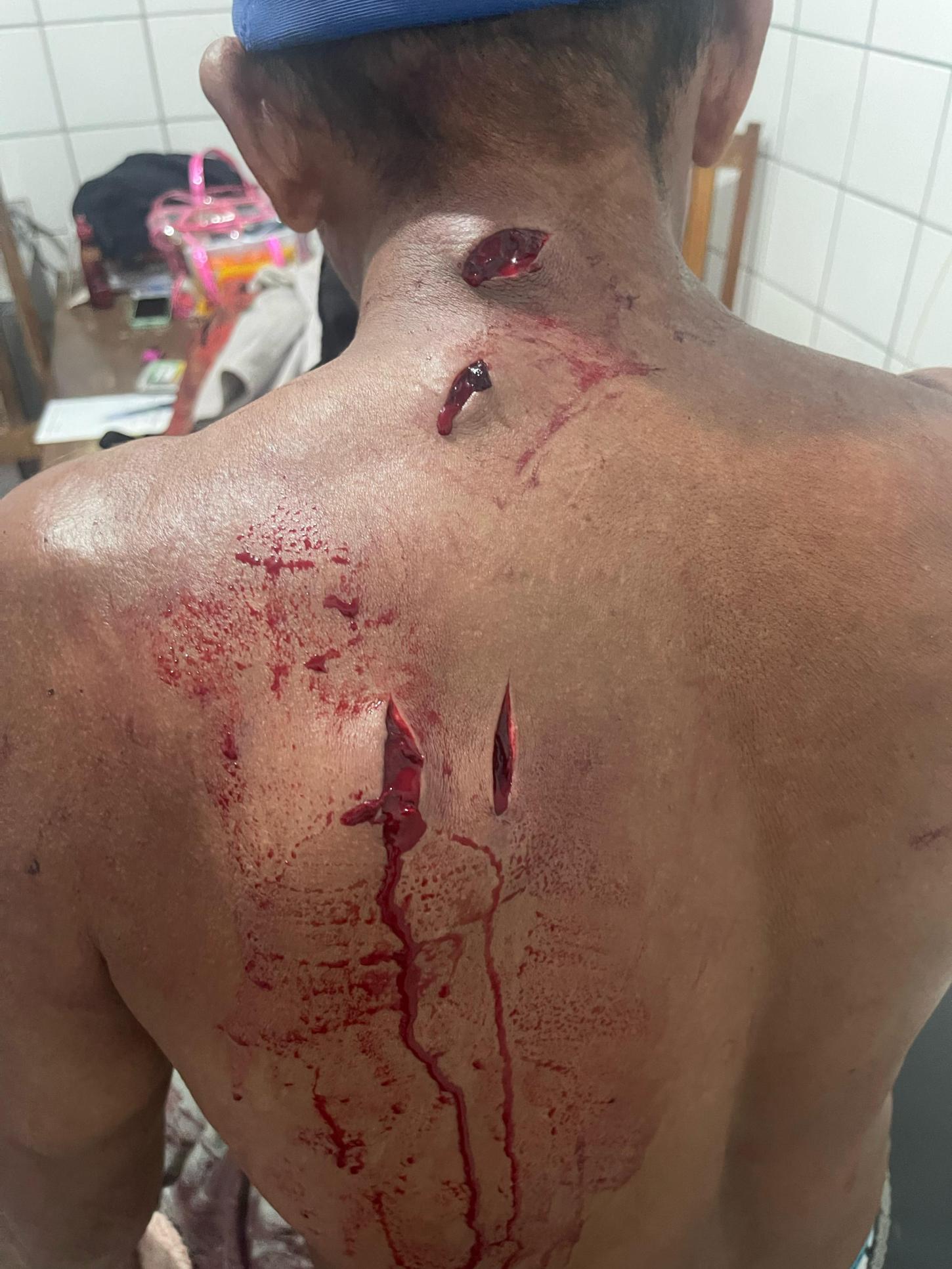 Irmão esfaqueado pelo próprio irmão na região do Arapixuna
