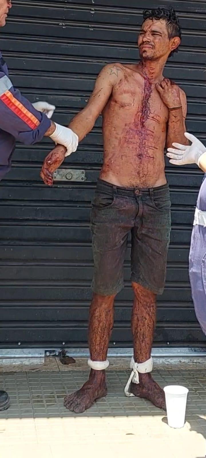 Elemento foi agredido e ao ser atendido pelo SAMU ameaça equipe e foge do hospital