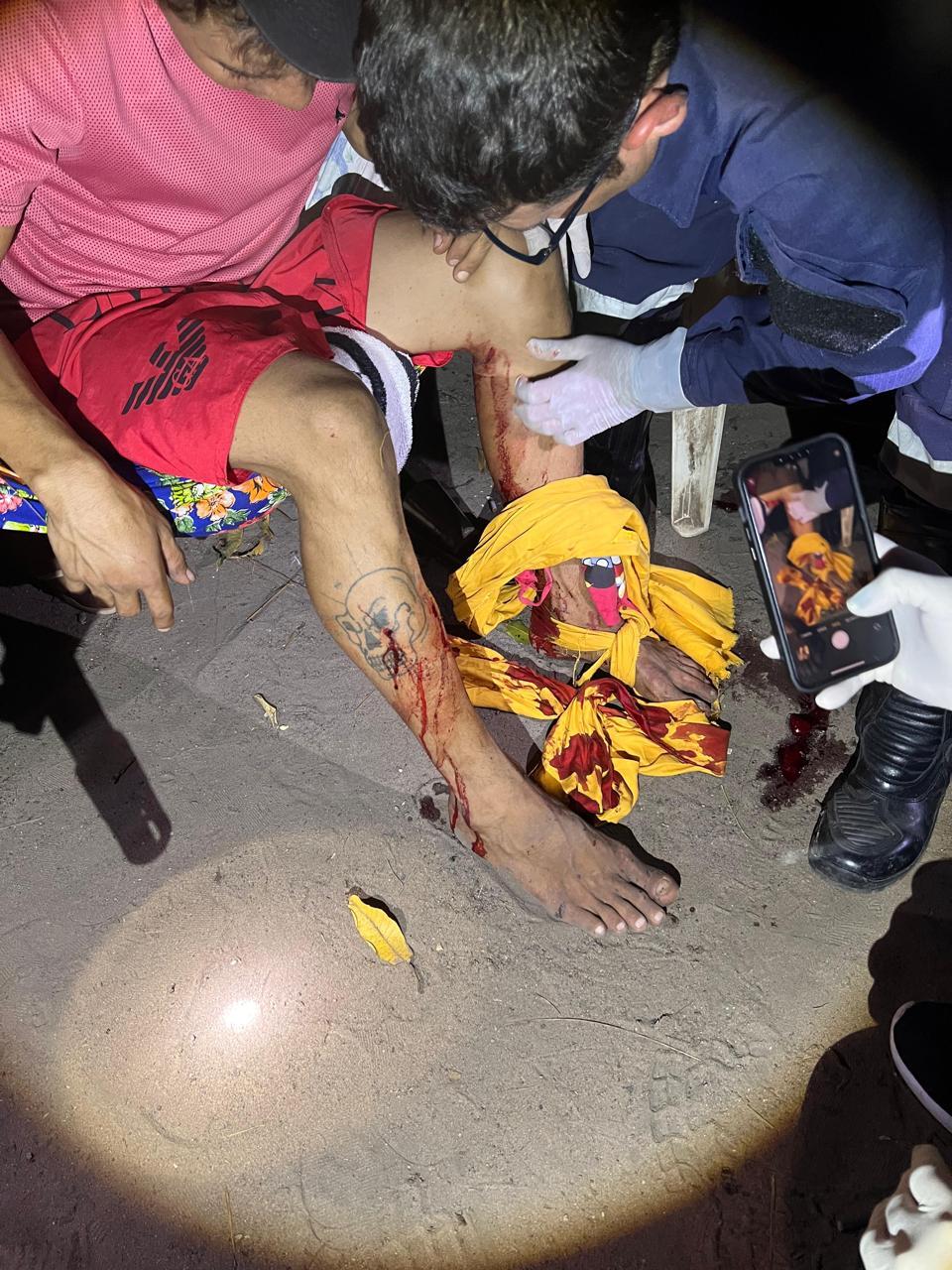 Jovem tomou 05 tiros nas pernas do próprio irmão