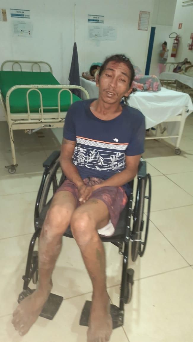 Cabeludo preso por furto de joias