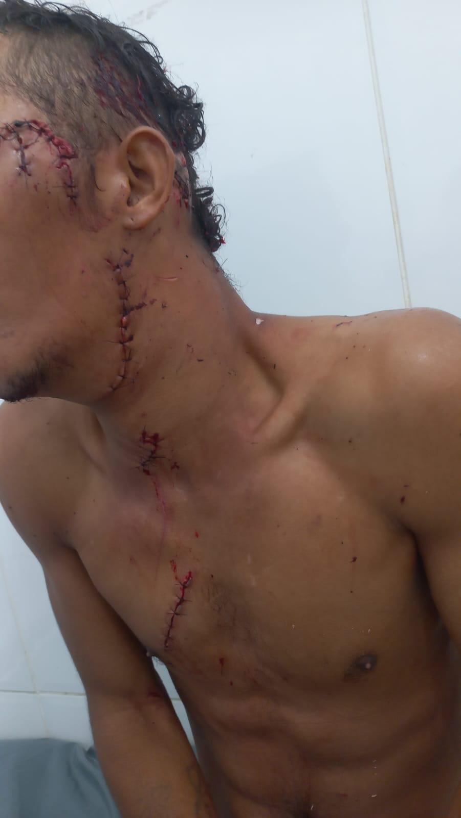 Jovem esfaqueado nas proximidades do Museu