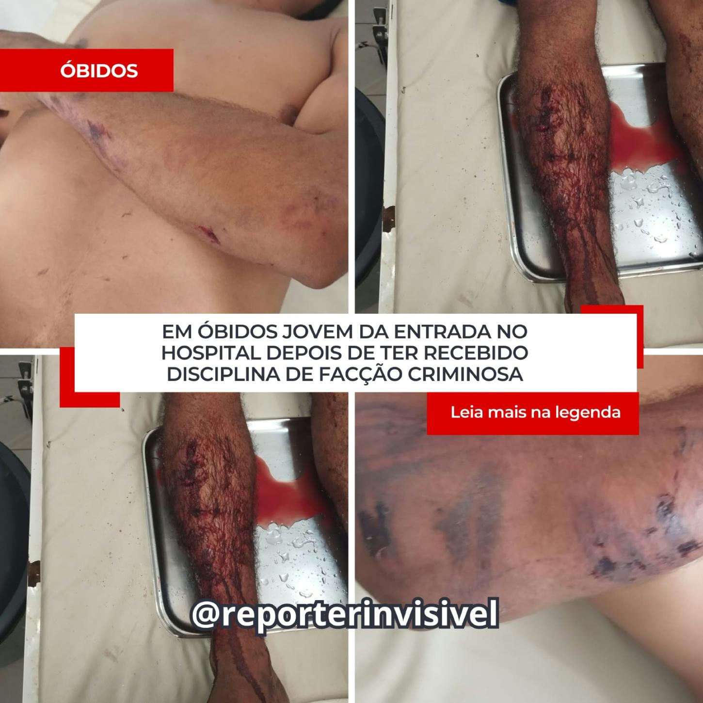 Na cidade de Óbidos homem procura hospital após receber disciplina de facção 
