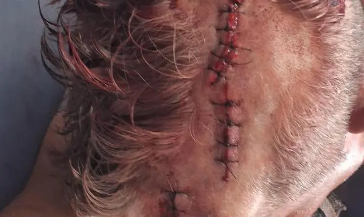 Conflito familiar no Distrito de Curuai 