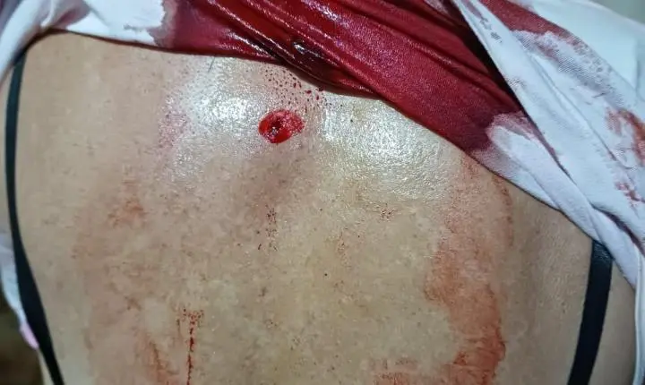 Homem morto e mulher atingida nas costas no garmpo São Domingos município de Itaituba 