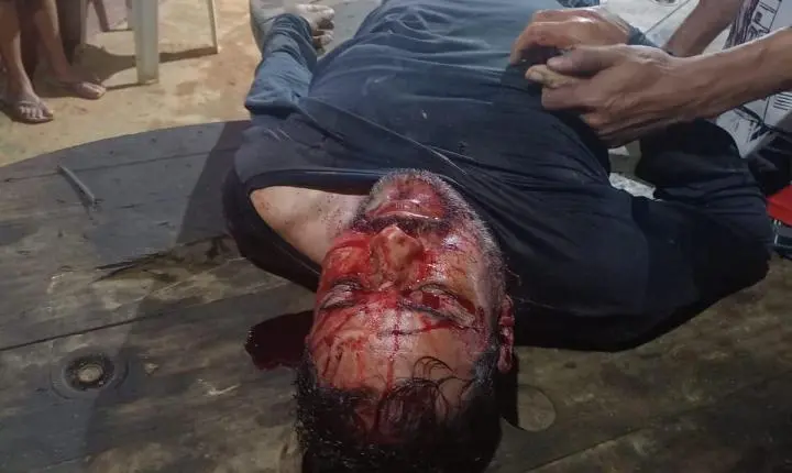 Homem morto e mulher atingida nas costas no garmpo São Domingos município de Itaituba 