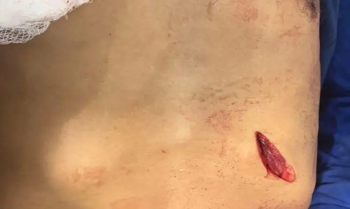 Mulher mata idoso em Alter do Chão 