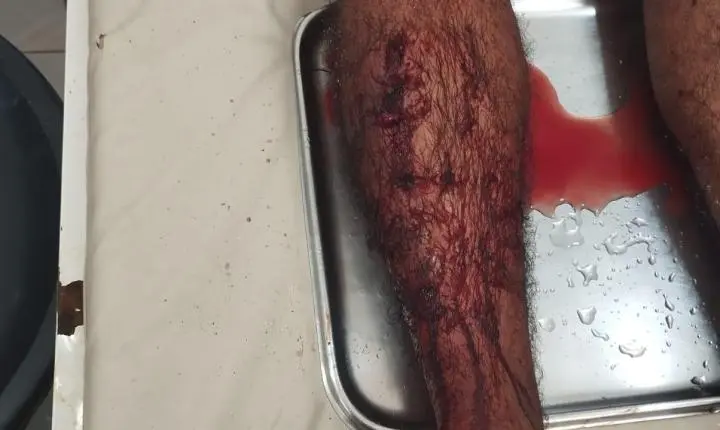 Na cidade de Óbidos homem procura hospital após receber disciplina de facção 