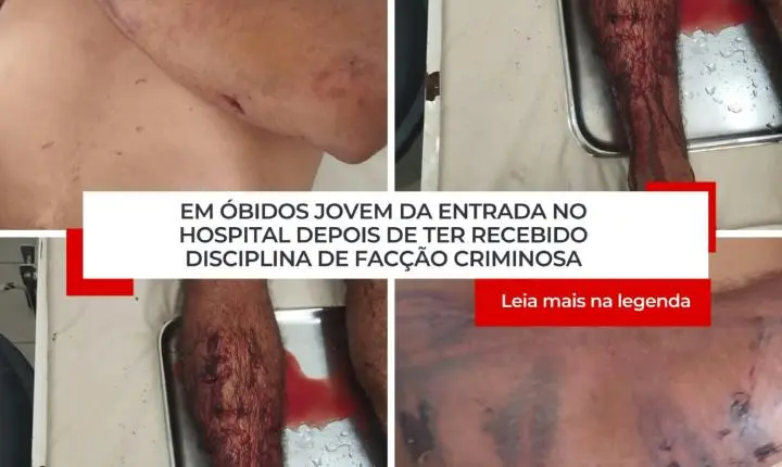 Na cidade de Óbidos homem procura hospital após receber disciplina de facção 
