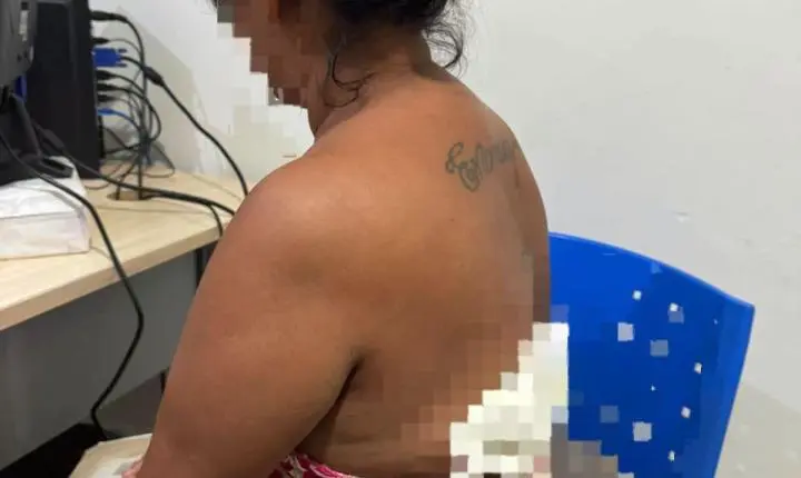 Tentativa de Feminicidio em Santarém 